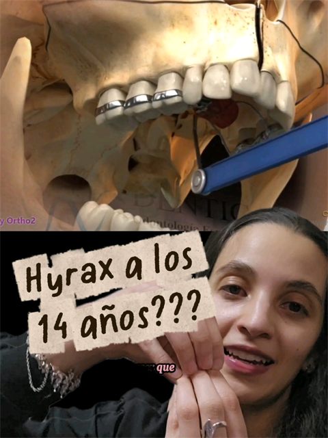 Cover of the playlist Hyrax